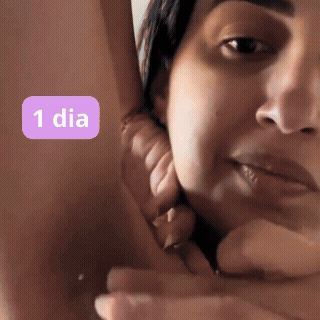 Clareamento progressivo